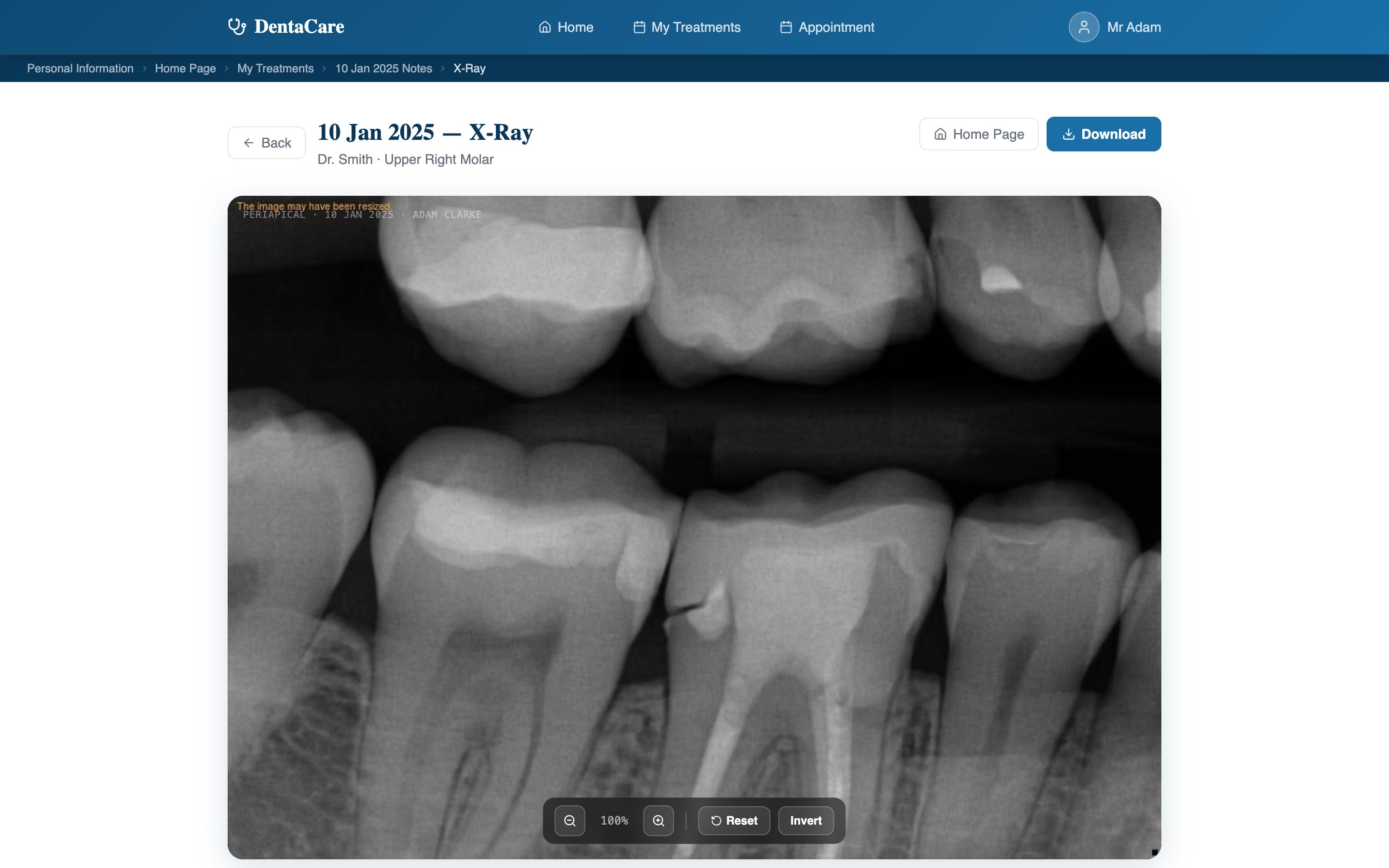 X-ray viewer with zoom, invert and download.